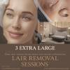 3 Extra Large Laser Hair Removal Sessions
