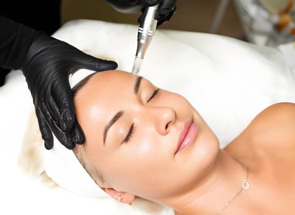 Laser Genesis vs RF Microneedling NYC