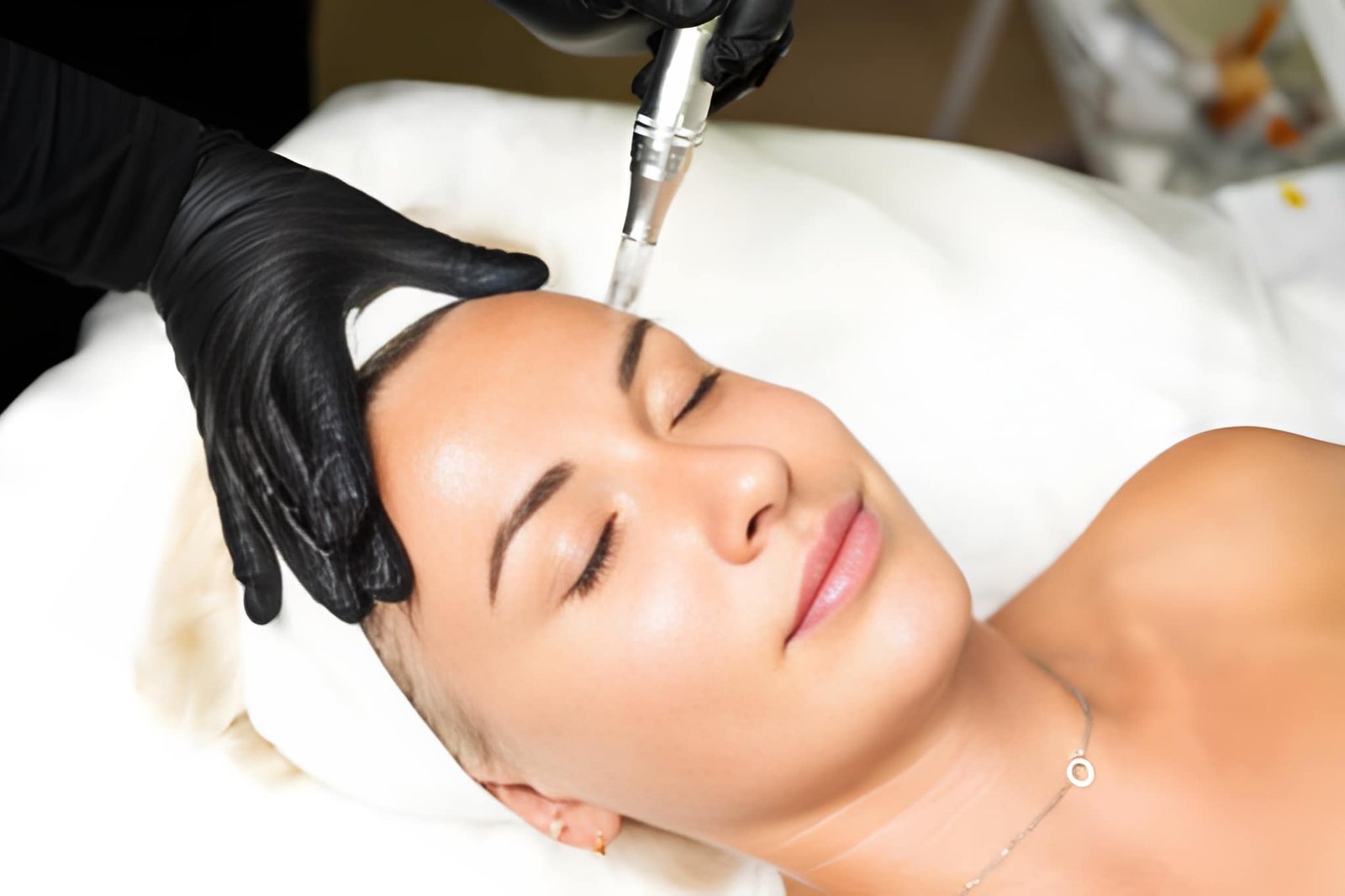 Laser Genesis vs RF Microneedling NYC